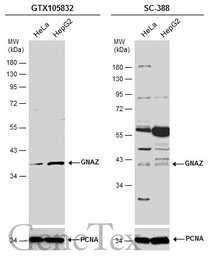 Anti-GNAZ antibody [N2C3] used in Western Blot (WB). GTX105832