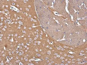 Anti-GNAZ antibody [N2C3] used in IHC (Paraffin sections) (IHC-P). GTX105832