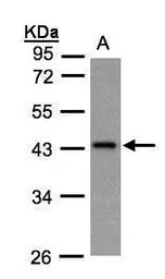 Anti-GNAZ antibody [N2C3] used in Western Blot (WB). GTX105832