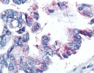 Anti-Survivin antibody [32.1] used in IHC (Paraffin sections) (IHC-P). GTX10584