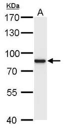 Anti-p90 RSK1 antibody used in Western Blot (WB). GTX105842