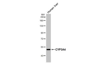 Anti-CYP3A4 antibody [N2C2], Internal used in Western Blot (WB). GTX105871