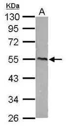 Anti-CaMKI gamma antibody used in Western Blot (WB). GTX105879