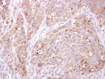 Anti-ETNK1 antibody [N2C3] used in IHC (Paraffin sections) (IHC-P). GTX105887