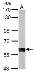 Anti-SUOX antibody [N1C1] used in Western Blot (WB). GTX105902