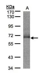Anti-SUOX antibody [N1C1] used in Western Blot (WB). GTX105902