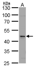 Anti-Calsequestrin 2 antibody used in Western Blot (WB). GTX105914
