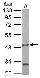 Anti-PANK1 antibody [N3C3] used in Western Blot (WB). GTX105920