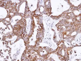 Anti-PANK1 antibody [N3C3] used in IHC (Paraffin sections) (IHC-P). GTX105920