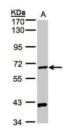 Anti-PANK1 antibody [N3C3] used in Western Blot (WB). GTX105920