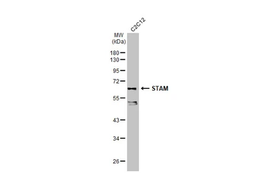 Anti-STAM antibody used in Western Blot (WB). GTX105927