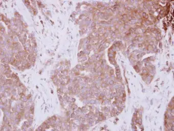 Anti-STAM antibody used in IHC (Paraffin sections) (IHC-P). GTX105927