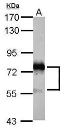 Anti-STAM antibody used in Western Blot (WB). GTX105927