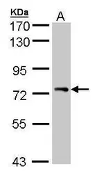 Anti-STAM antibody used in Western Blot (WB). GTX105927