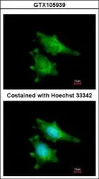 Anti-RIP2 antibody [N3C3] used in Immunocytochemistry/ Immunofluorescence (ICC/IF). GTX105939