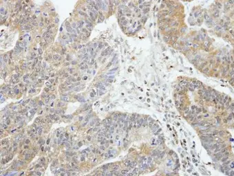 Anti-RIP2 antibody [N3C3] used in IHC (Paraffin sections) (IHC-P). GTX105939