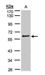 Anti-RIP2 antibody [N3C3] used in Western Blot (WB). GTX105939