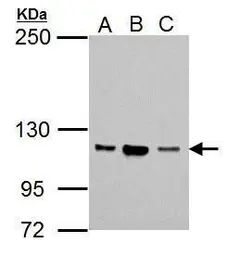 Anti-NSUN1 antibody [N2C2], Internal used in Western Blot (WB). GTX105945