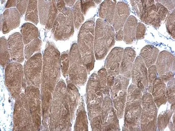 Anti-DPP3 antibody [N2C1], Internal used in IHC (Paraffin sections) (IHC-P). GTX105949