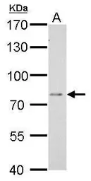 Anti-DPP3 antibody [N2C1], Internal used in Western Blot (WB). GTX105949