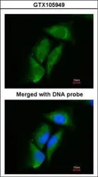 Anti-DPP3 antibody [N2C1], Internal used in Immunocytochemistry/ Immunofluorescence (ICC/IF). GTX105949