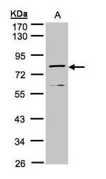 Anti-DPP3 antibody [N2C1], Internal used in Western Blot (WB). GTX105949