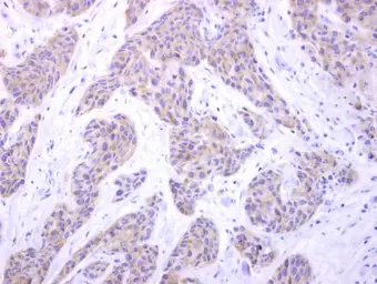 Anti-PIGK antibody [N1C2] used in IHC (Paraffin sections) (IHC-P). GTX105967