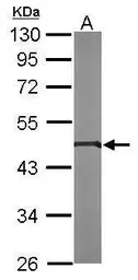 Anti-PIGK antibody [N1C2] used in Western Blot (WB). GTX105967