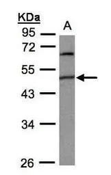 Anti-PIGK antibody [N1C2] used in Western Blot (WB). GTX105967