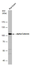 Anti-alpha 1 Catenin antibody used in Western Blot (WB). GTX106014
