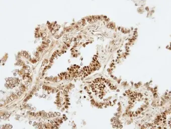 Anti-ZKSCAN3 antibody [N1C2] used in IHC (Paraffin sections) (IHC-P). GTX106039
