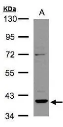 Anti-Rad51B antibody [N1C3] used in Western Blot (WB). GTX106045