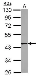 Anti-HSFY1+2 antibody used in Western Blot (WB). GTX106048