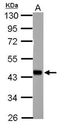 Anti-HSFY1+2 antibody used in Western Blot (WB). GTX106048