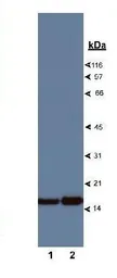 Anti-Profilin 1 antibody used in Western Blot (WB). GTX10608