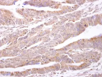 Anti-PTP1B antibody [N1N3] used in IHC (Paraffin sections) (IHC-P). GTX106104