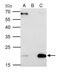 Anti-Sorcin antibody [N1C3] used in Immunoprecipitation (IP). GTX106105