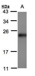 Anti-Sorcin antibody [N1C3] used in Western Blot (WB). GTX106105
