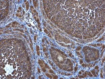 Anti-ATG4D antibody [N3C3] used in IHC (Paraffin sections) (IHC-P). GTX106114