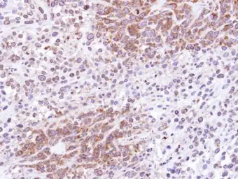 Anti-ATG4D antibody [N3C3] used in IHC (Paraffin sections) (IHC-P). GTX106114
