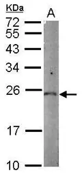 Anti-PGPEP1 antibody [N1C3] used in Western Blot (WB). GTX106120