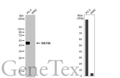 Anti-SIAT4A antibody used in Western Blot (WB). GTX106121
