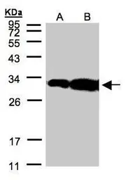 Anti-HOXC11 antibody [N1C2] used in Western Blot (WB). GTX106138