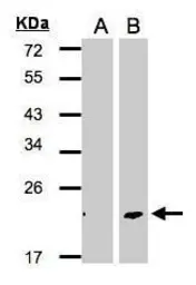 Anti-Dermatopontin antibody used in Western Blot (WB). GTX106150