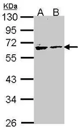 Anti-Arylsulfatase A antibody [N2C2], Internal used in Western Blot (WB). GTX106155