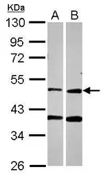 Anti-PPOX antibody [N3C3] used in Western Blot (WB). GTX106163