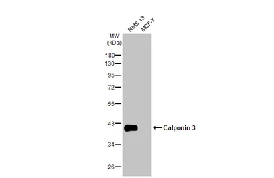 Anti-Calponin 3 antibody used in Western Blot (WB). GTX106174