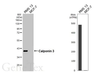 Anti-Calponin 3 antibody used in Western Blot (WB). GTX106174