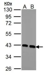 Anti-Calponin 3 antibody used in Western Blot (WB). GTX106174