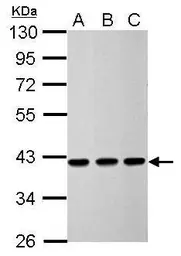 Anti-Calponin 3 antibody used in Western Blot (WB). GTX106174